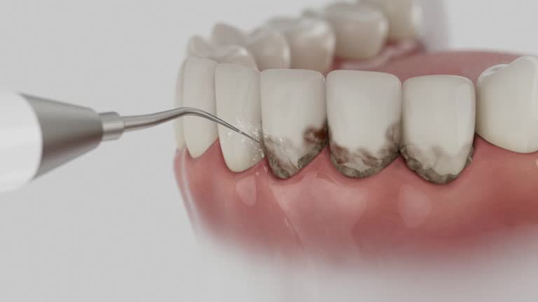 Trusted Dental Implants service in Peabody, MA - Dentist Open Now